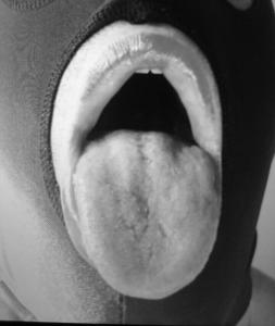 Photo de bouchexpertefdg92